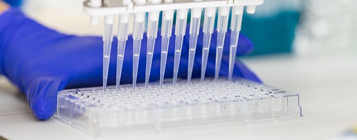 Krystal BioTech güçlü gelirlerine rağmen düşüşte