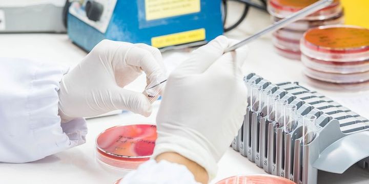 Jaguar Health’in zararı daraldı ancak gelirler de azaldı