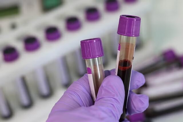 Oncocyte’ın testi biyopsi ihtiyacını belirliyor
