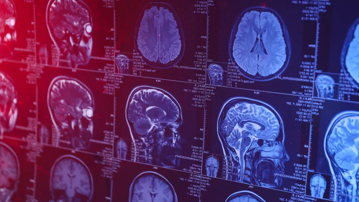NeuroOne Medical Tech’in gelirleri 234% arttı