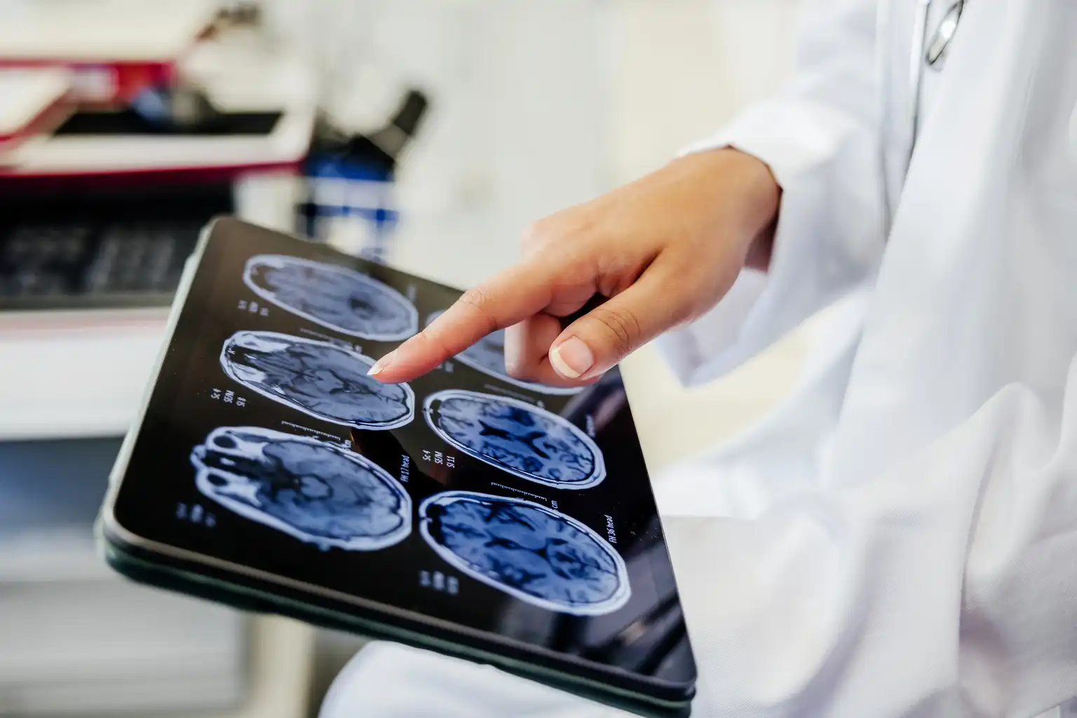 ClearPoint Neuro’nun cihazı AB’de onay aldı