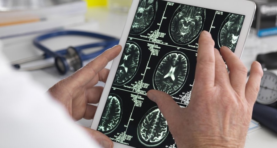 Autonomix Medical’ın zararı beklentilerin altında