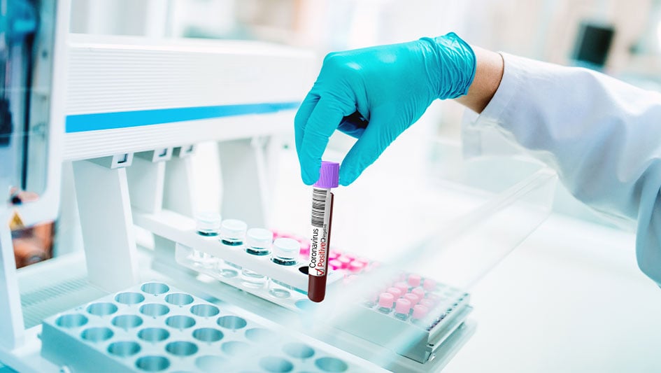 Solid Biosciences’tan umut verici gen tedavisi sonuçları