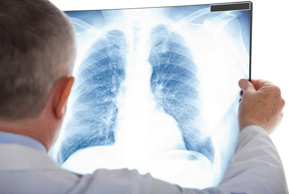 Pulmonx’in üçüncü çeyrek zararı beklentilerin altında
