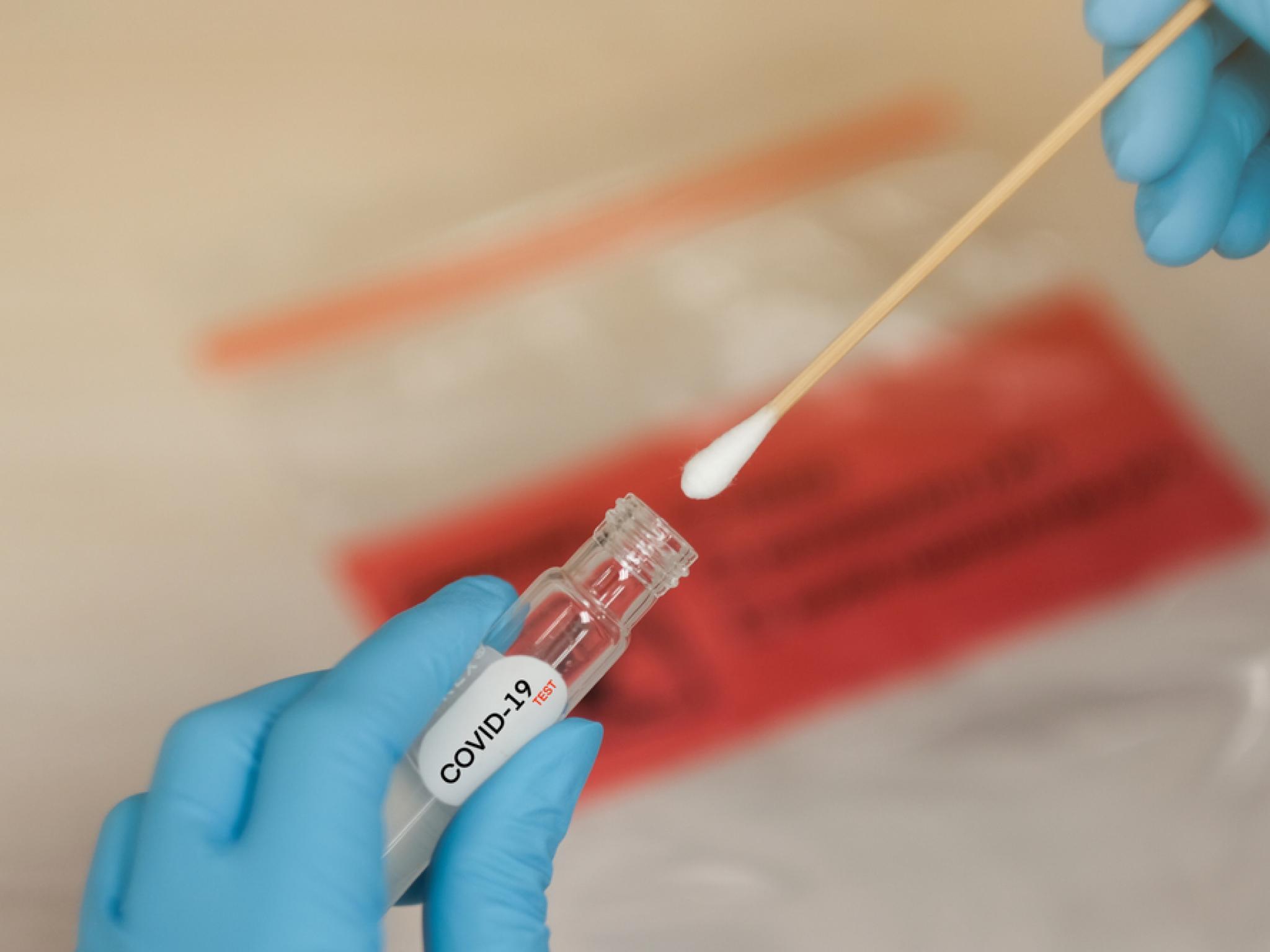 Co-Dx PCR COVID-19 testi FDA başvurusu geri çekildi