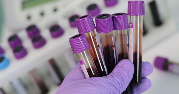 MDxHealth’in zararı beklentilerin altında kaldı