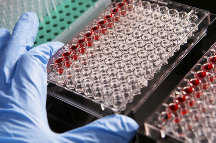 Soleno Therapeutics’in zararı beklentileri aştı
