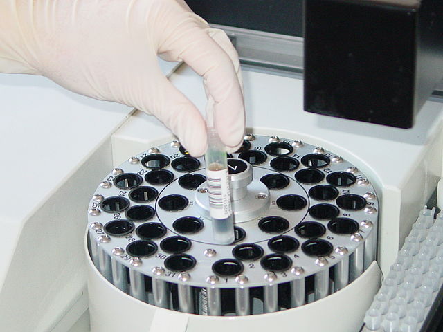 Sagimet Biosciences’ın zararı beklentilerin altında