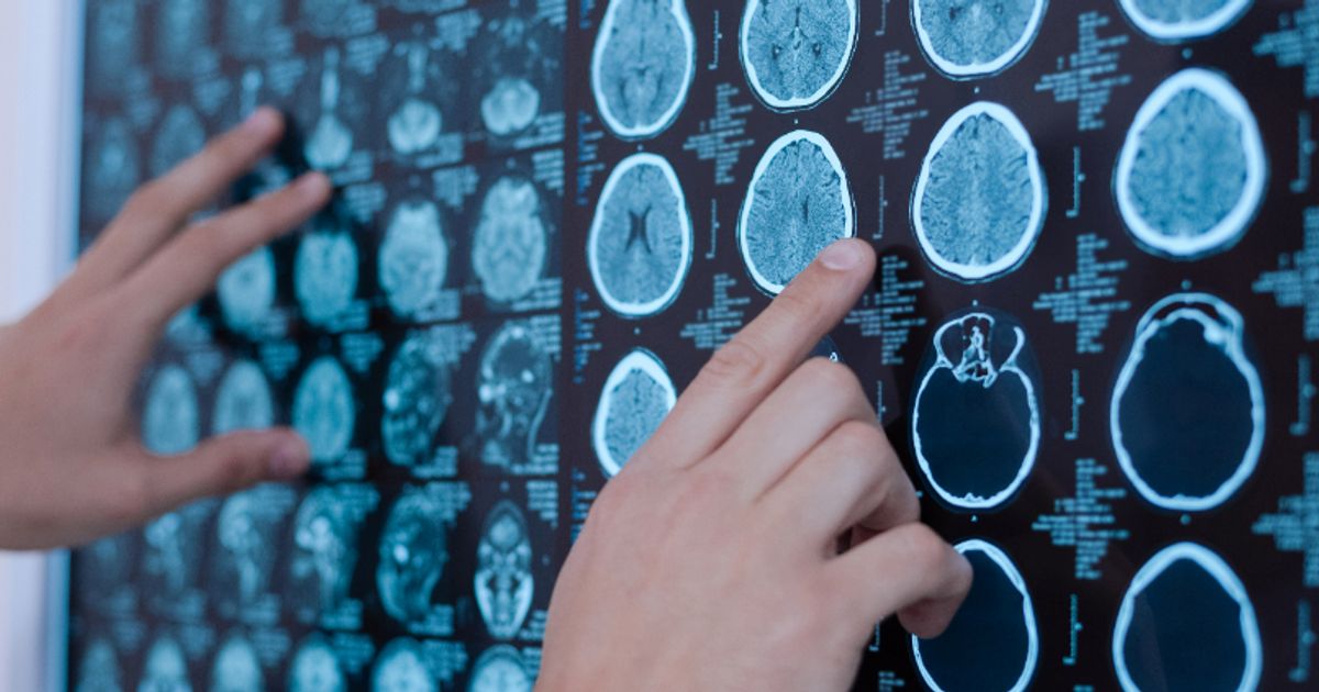 TransCode’un kanser ilacı klinik denemelerde ilerledi