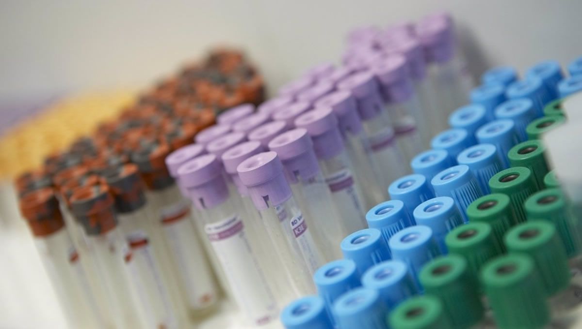 Surrozen’in zararı beklentileri aştı
