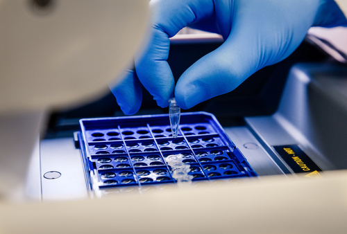 Predictive Oncology’nin zararı azaldı