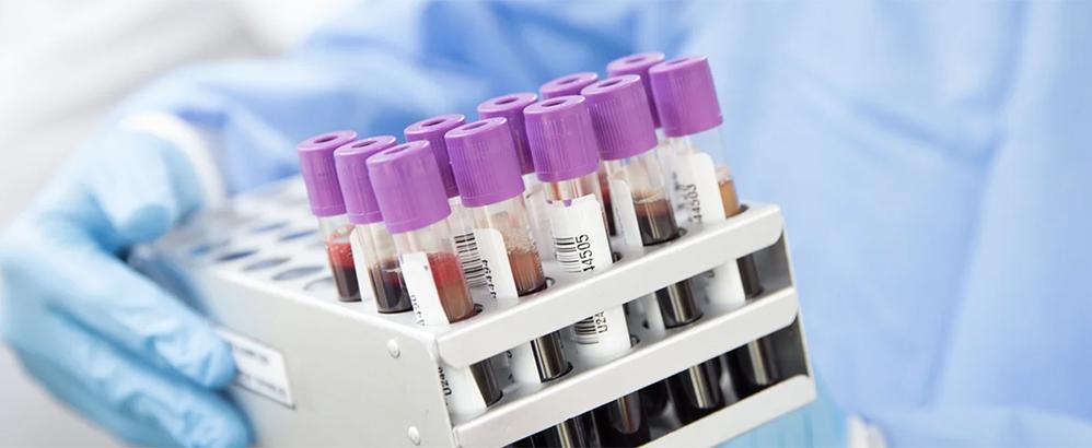 Onconetix ve Ocuvex birleşme planı açıkladı