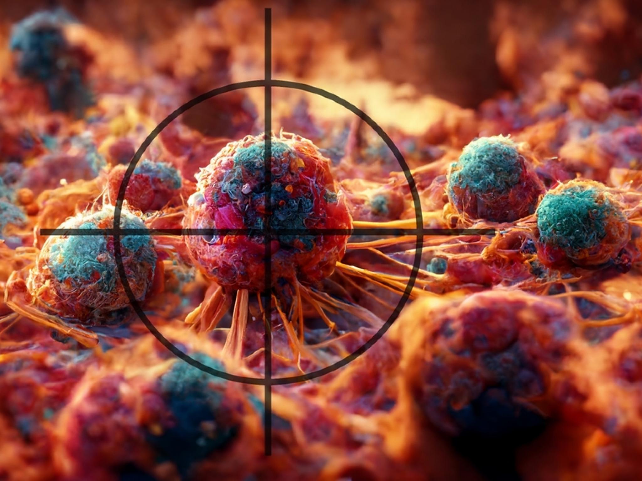 CG Oncology’nin mesane kanseri ilacı umut veriyor