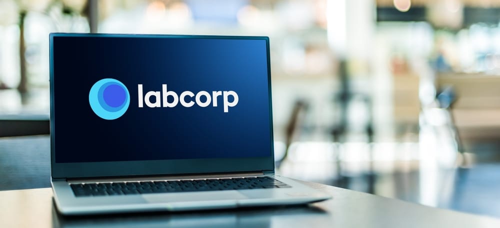 Laboratory Corp’un kârı beklentilerin altında kaldı