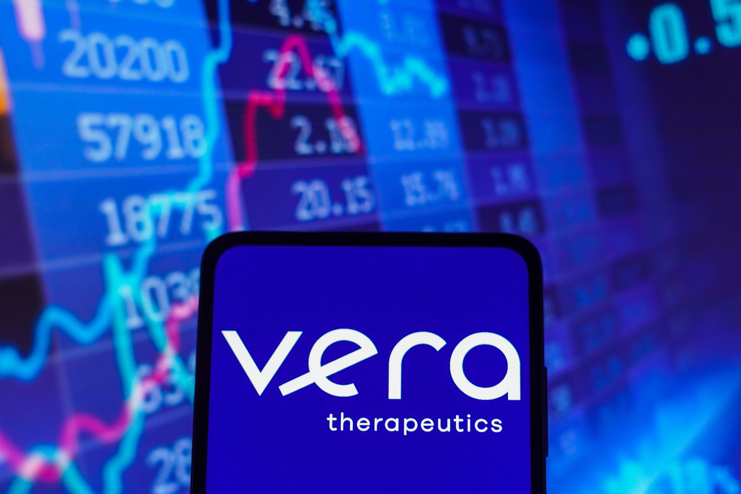 Vera Therapeutics’in zararı beklentileri aştı
