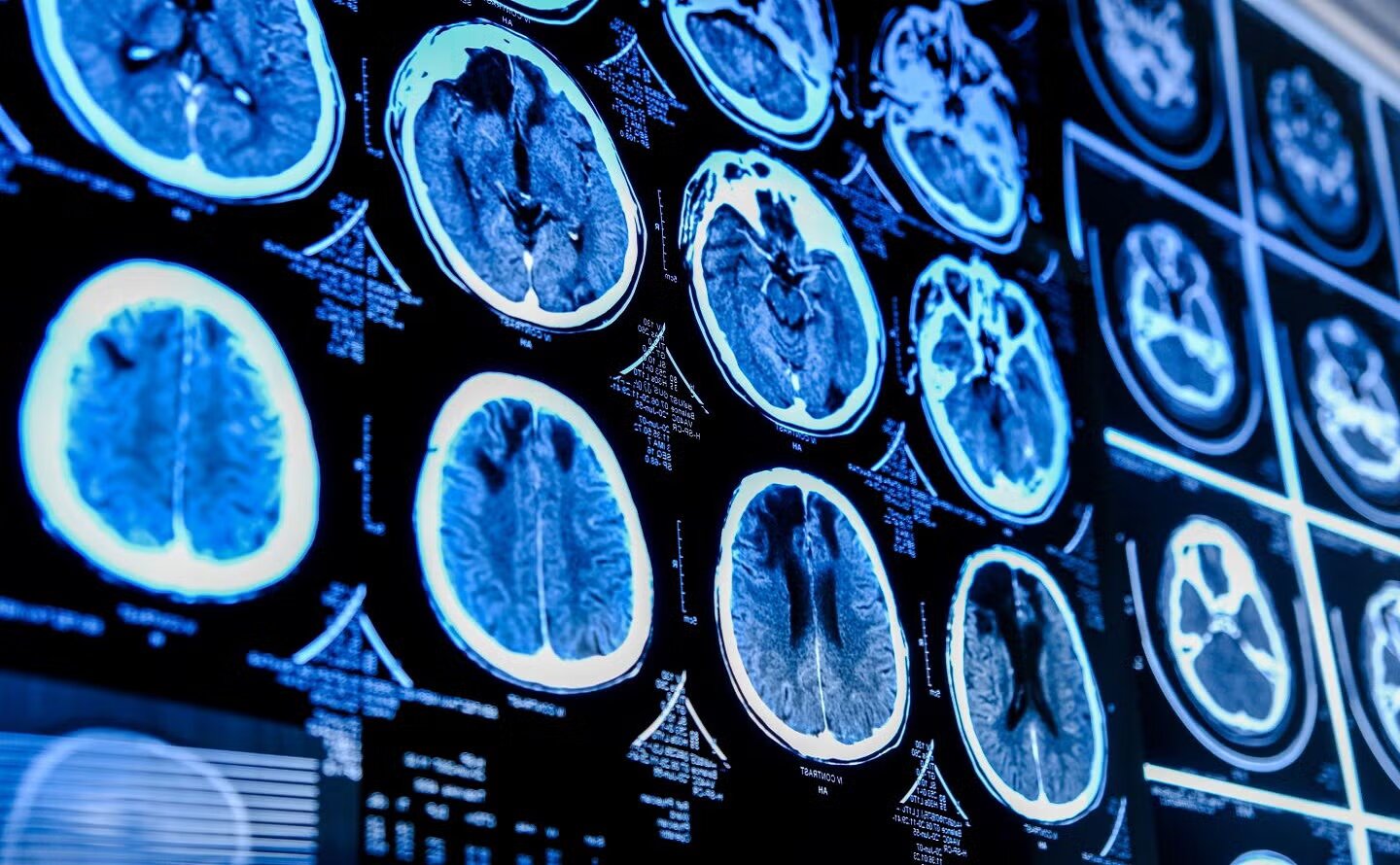 Firefly Neuroscience’ın gelirleri 258% arttı