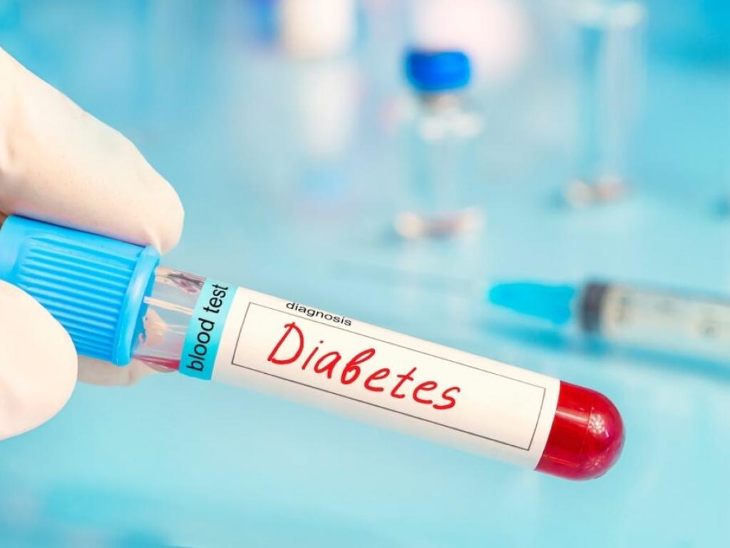 ProKidney hisseleri olumlu deneme sonuçlarıyla fırladı