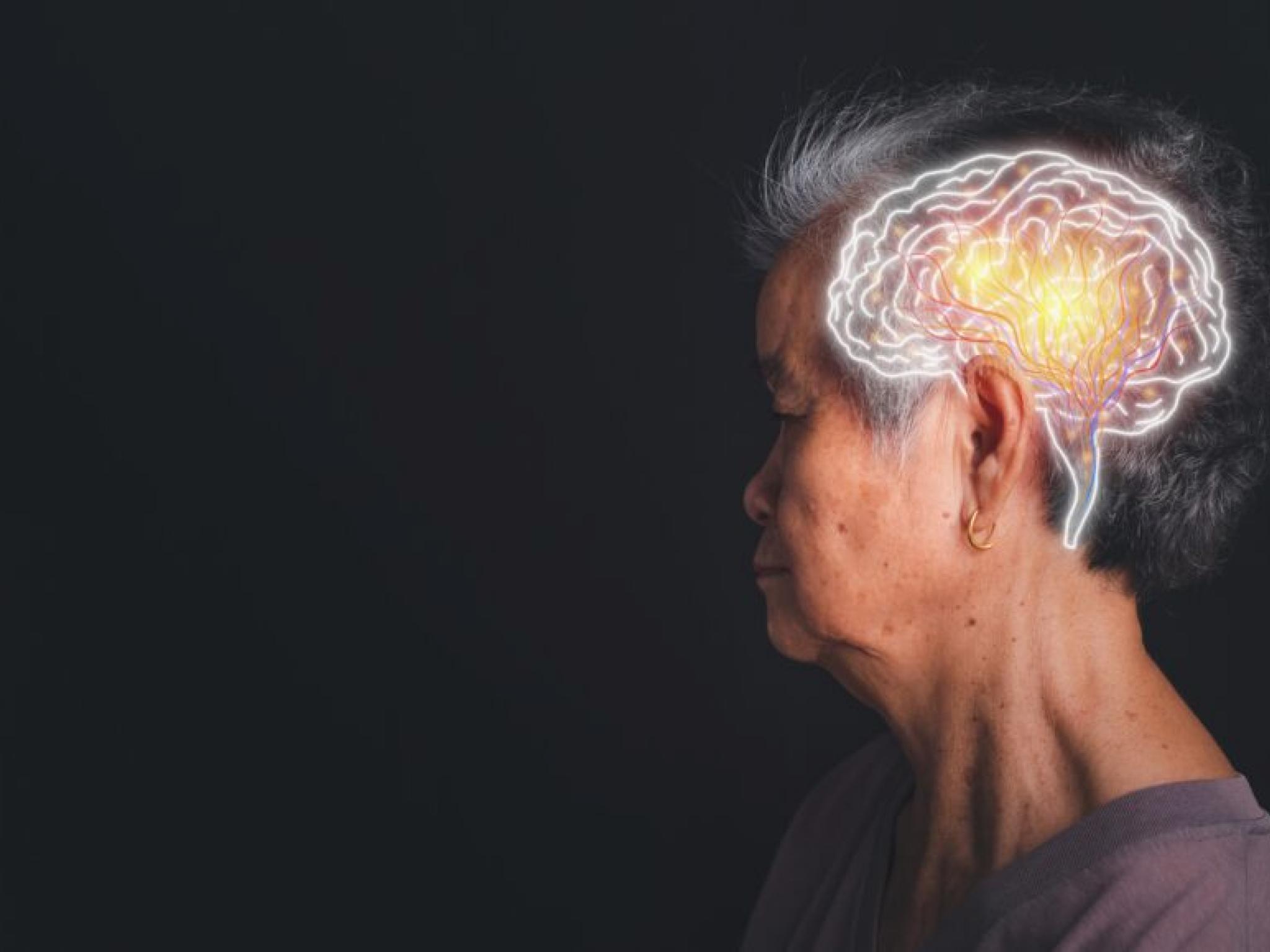 CervoMed’in demans ilacı olumlu sonuçlar verdi
